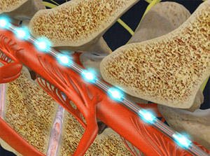 Spinal Cord Simulation